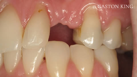 Before